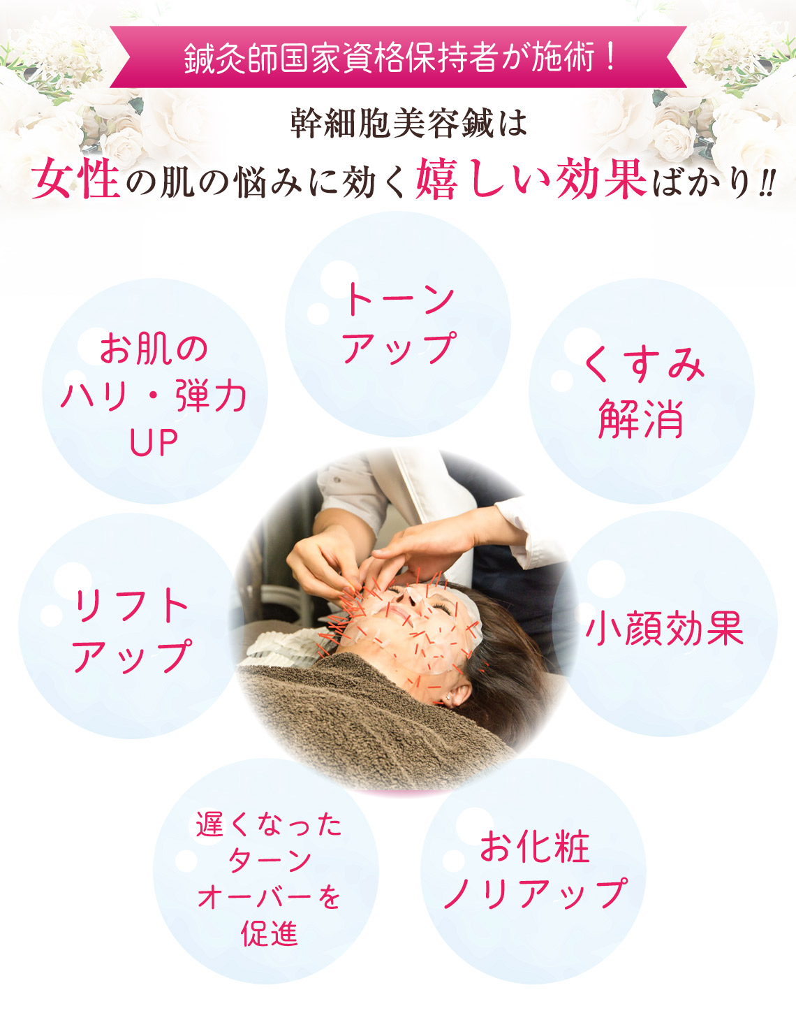 幹細胞美容鍼特徴