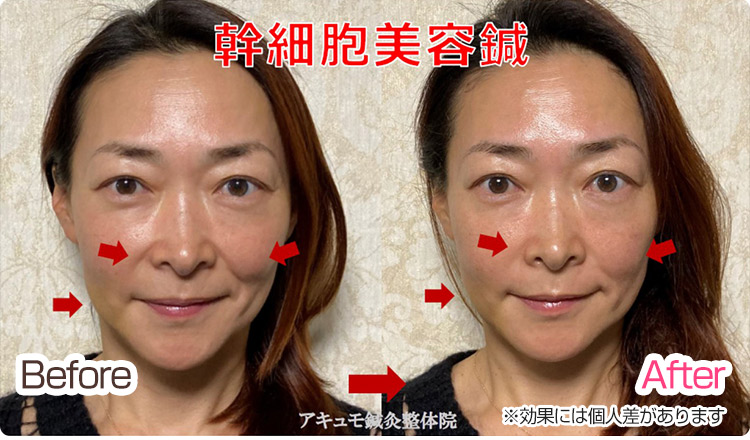 ビフォーアフター2