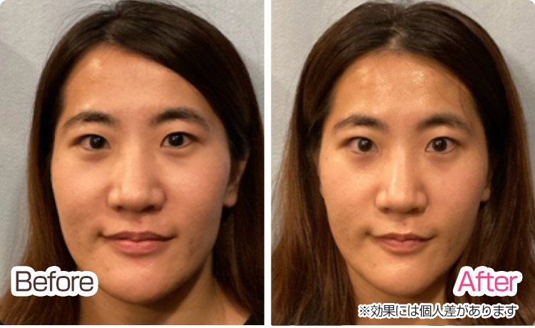 ビフォーアフター