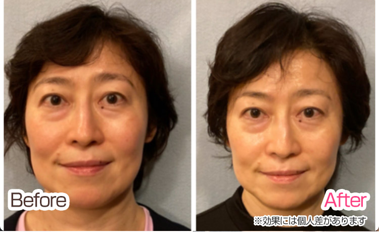 ビフォーアフター