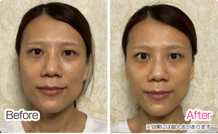 ビフォーアフター