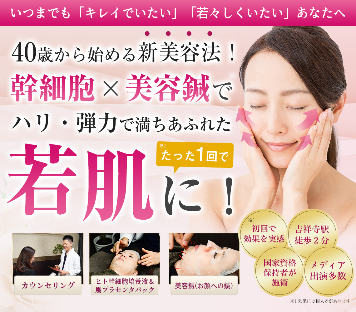 幹細胞美容鍼メインイメージ